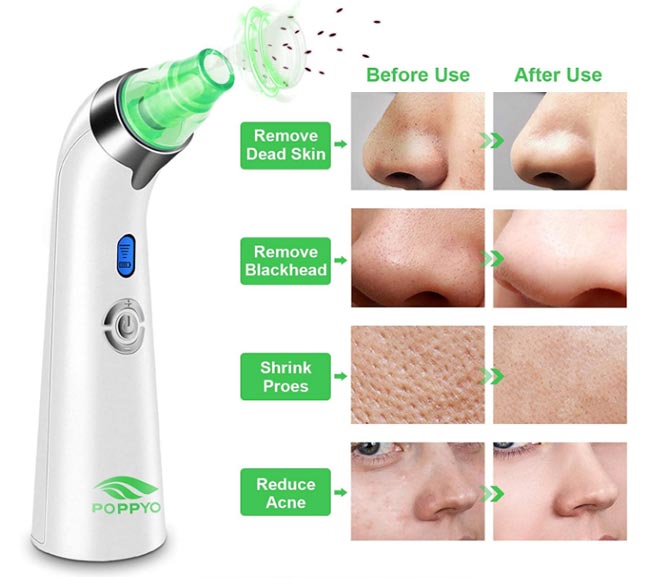 Blackhead-Remover-Pore-Vacuum